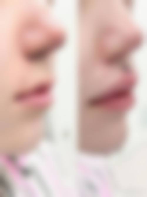 四、合肥高新区佳禾医疗美容门诊部特色项目