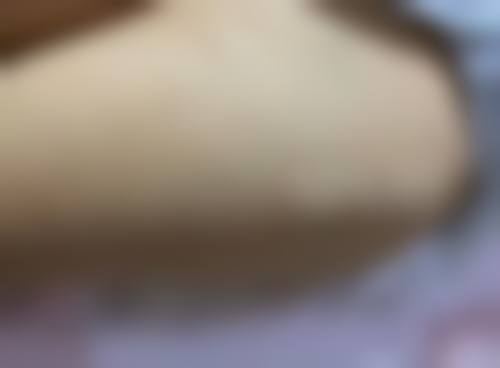 九、河南科技大学第一附属医院医疗美容科真实的患者评价