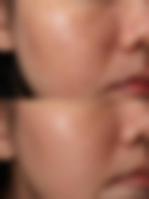 四、杭州佰欧克医疗美容诊所特色项目