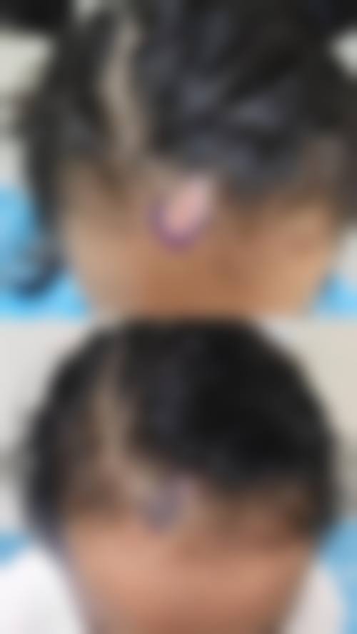 三、韩国毛治植发中 心诊疗项目有哪些？