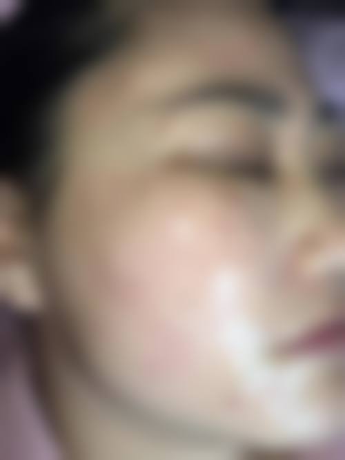 八、佛山市三水区人民医院(医疗美容科)真实的患者评价