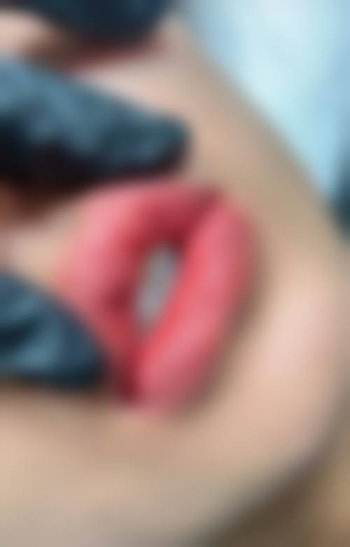 四、佛山市三水区人民医院(医疗美容科)特色项目