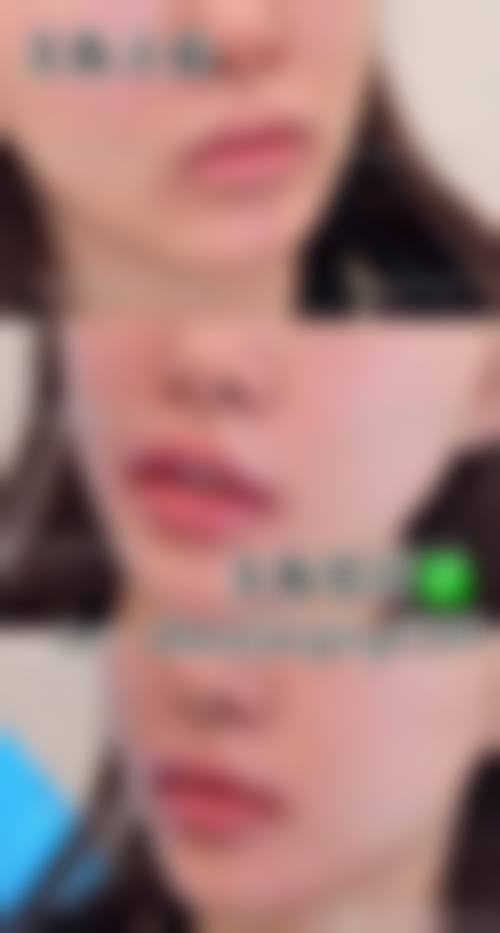 三、齐齐哈尔绣颜挚美医疗美容门诊部诊疗项目有哪些？