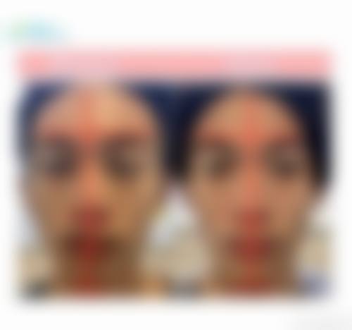 四、广西医 科 大学附属前列医院整形美容中 心特色项目