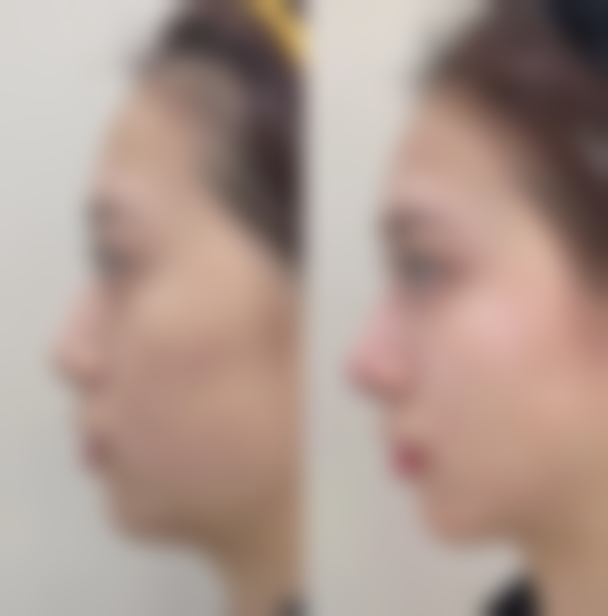 二、河南科技大学第一附属医院医疗美容科怎么样?