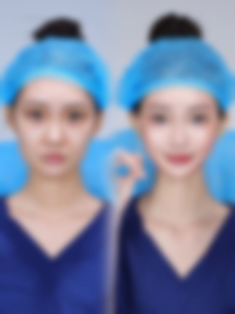 九、上海颜大整形医院真实的患者评价