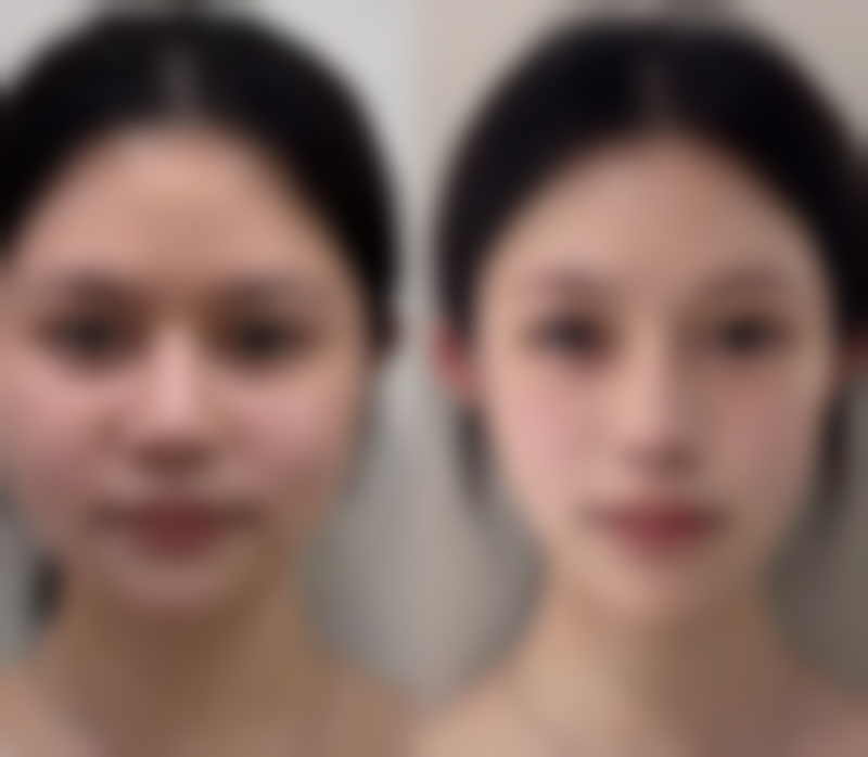 {眼霜到底能不能去眼袋和皱纹？了解作用与局限，找到改善眼周问题的有效方法！ 