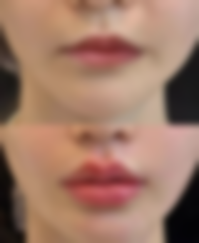 四、美诗沁世茂医疗美容特色项目