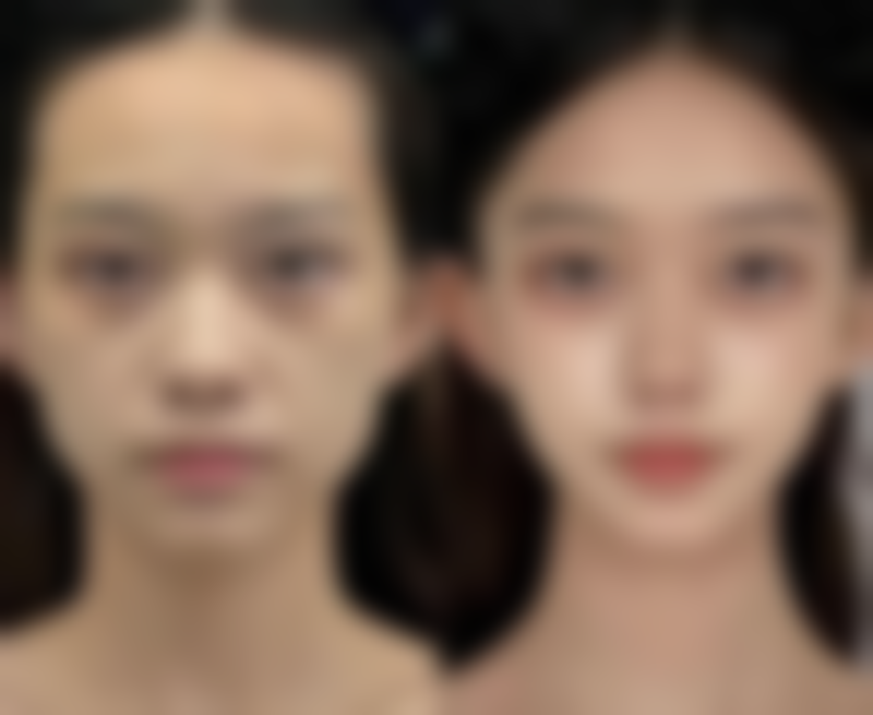 三、复旦大学附属华东医院(整形外科)诊疗项目有哪些？