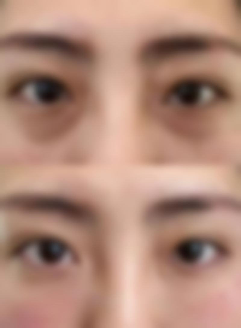 四、不同激光类型的特点