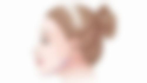 {埋线双眼皮20天还不消肿正常吗？了解原因与应对办法助你安心恢复 