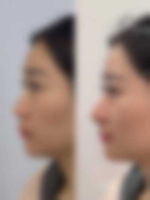 四、烟台瑞雅韩医疗美容诊所特色项目