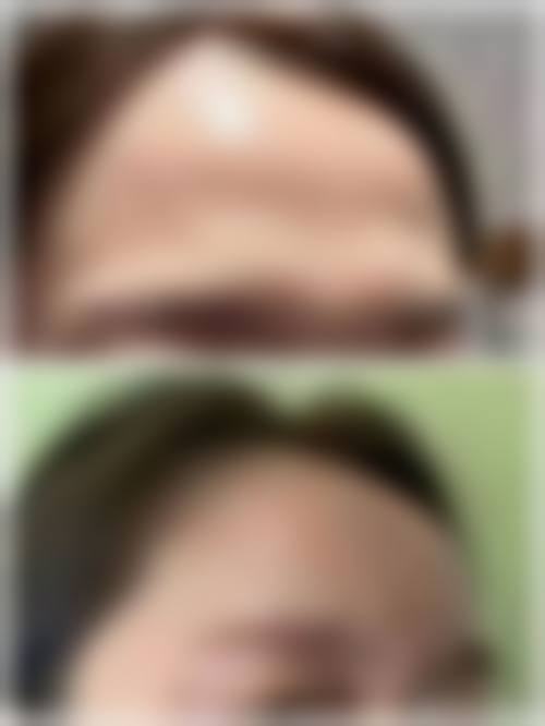 三、朝阳京城皮肤医院整形科诊疗项目有哪些？