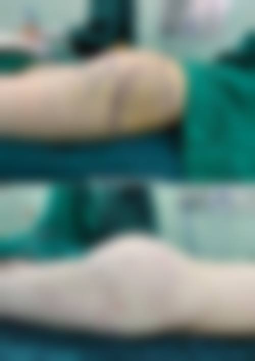 六、深圳三等甲医院(北大深圳)地址及交通