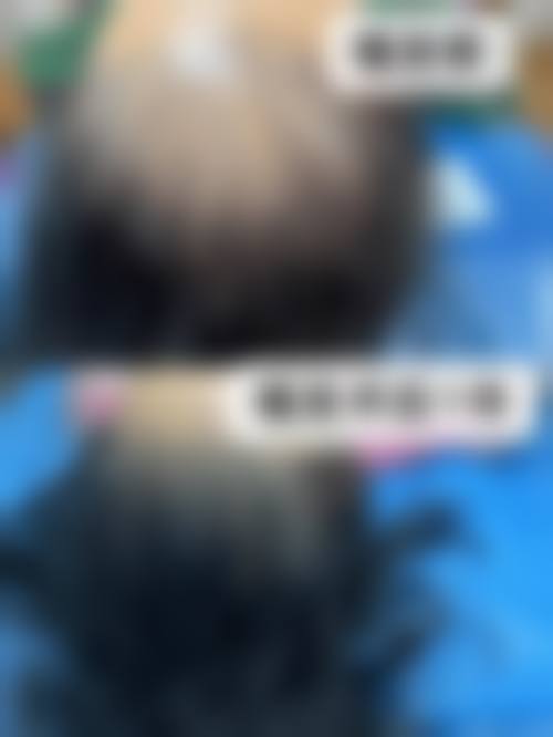 三、广州科发源植发中 心诊疗项目有哪些？