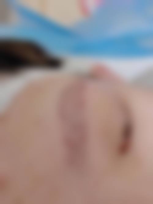 八、广州科发源植发中 心预约方式