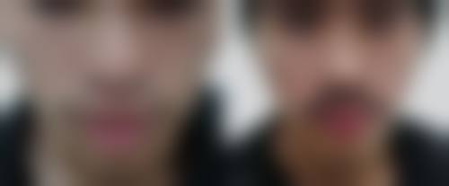 四、广州科发源植发中 心特色项目