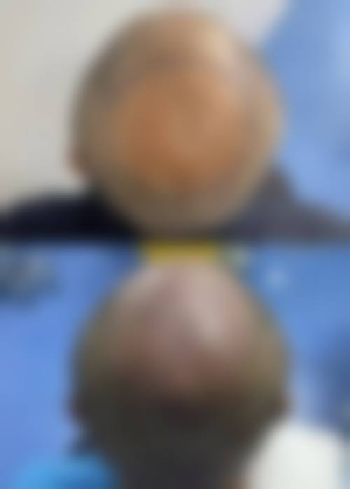 二、广州科发源植发中 心怎么样？