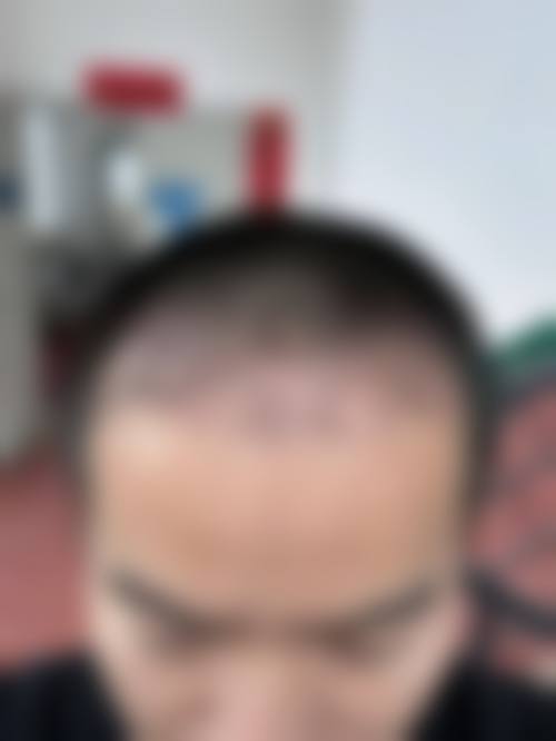 二、延吉延世整形医院怎么样?