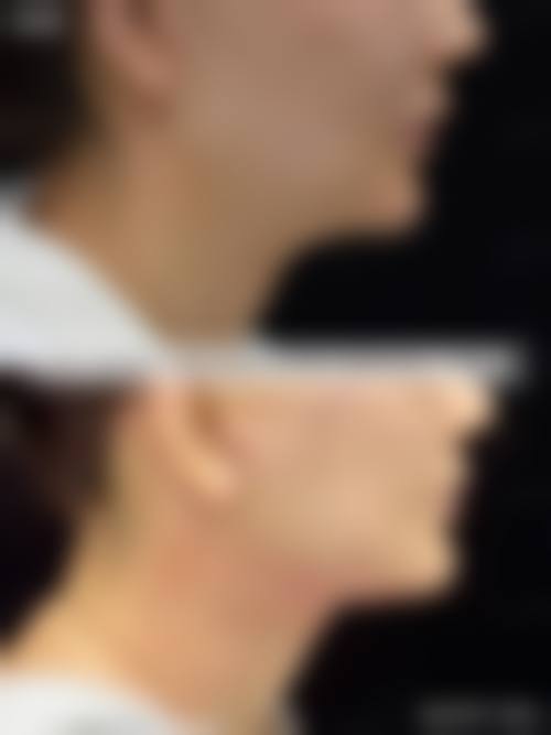 四、兰州中医医院特色项目