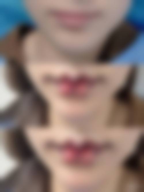 二、郑州市金水区都市风韵医疗美容诊所怎么样？