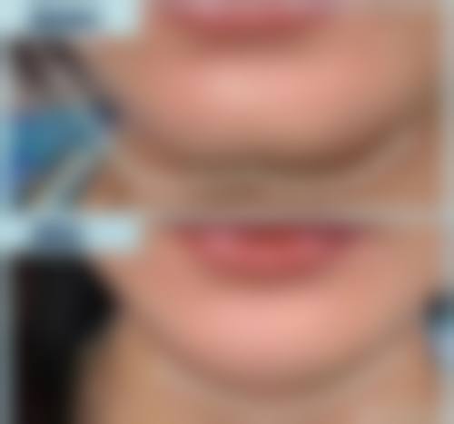 三、深圳三等甲医院(北大深圳)诊疗项目有哪些?