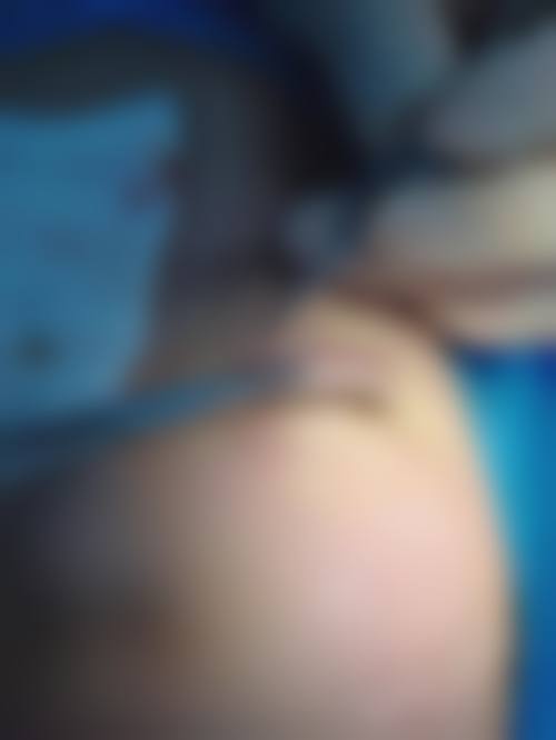 四、上海璞妍三季医疗美容门诊部特色项目