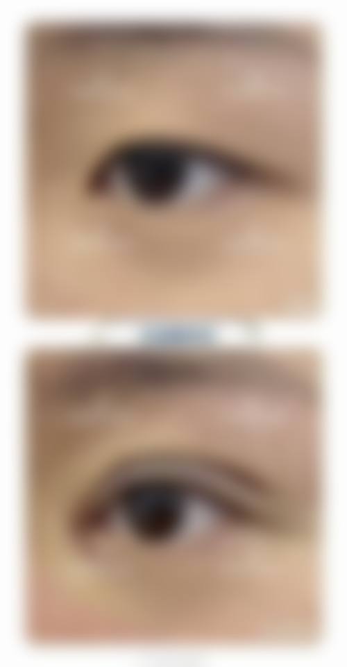 二、上海璞妍三季医疗美容门诊部怎么样？