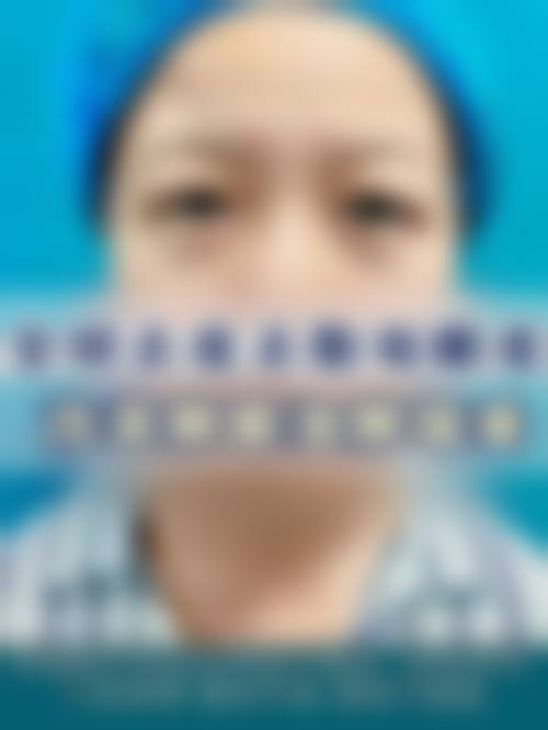 四、嘉兴禾美医疗美容医院特色项目