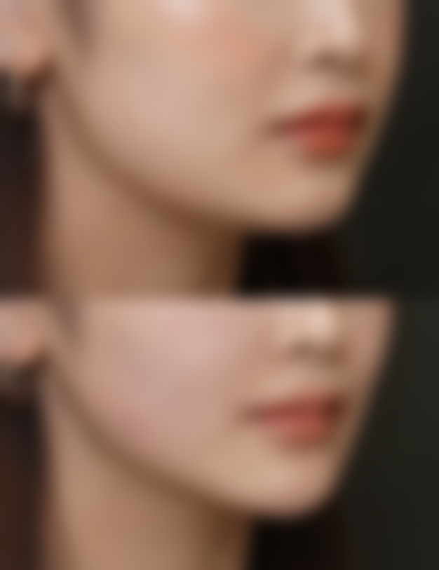 {割双眼皮可以种睫毛吗？了解恢复周期与注意事项让你美目更添魅力 