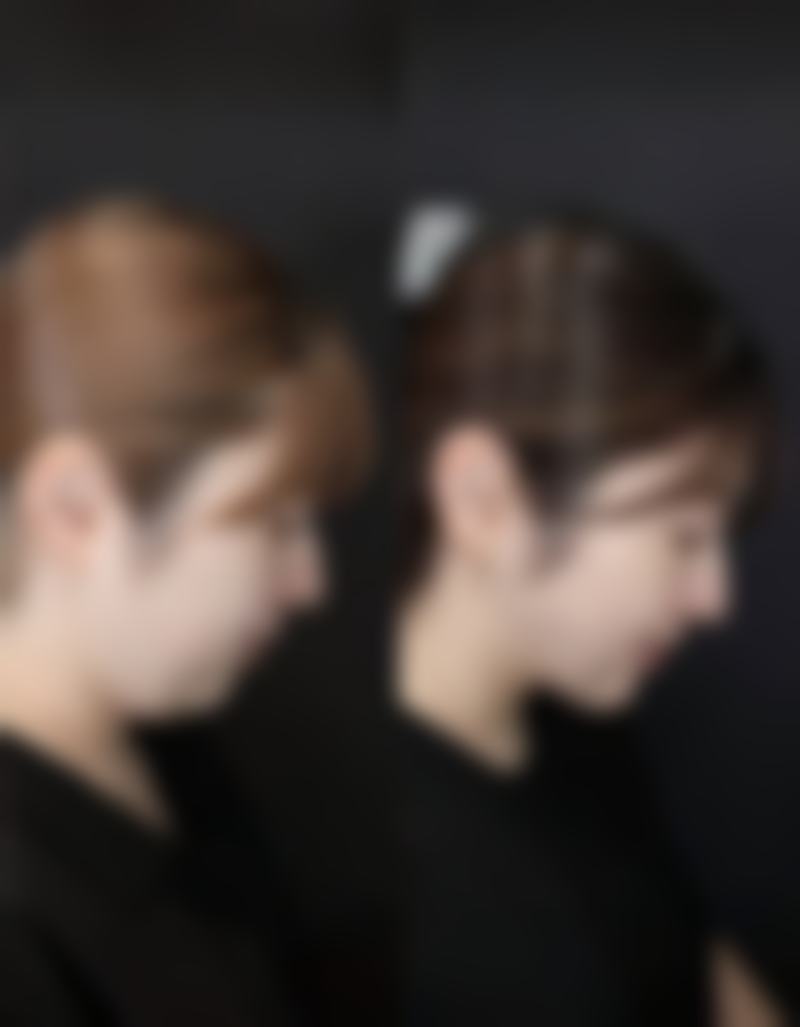 五、孩子脸上的疤痕变黑需就医的情况