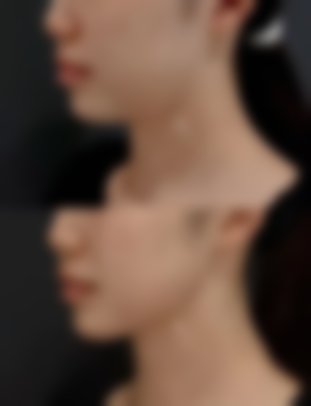 八、徐州泉山王医生(王莹)医疗美容诊所真实的患者评价