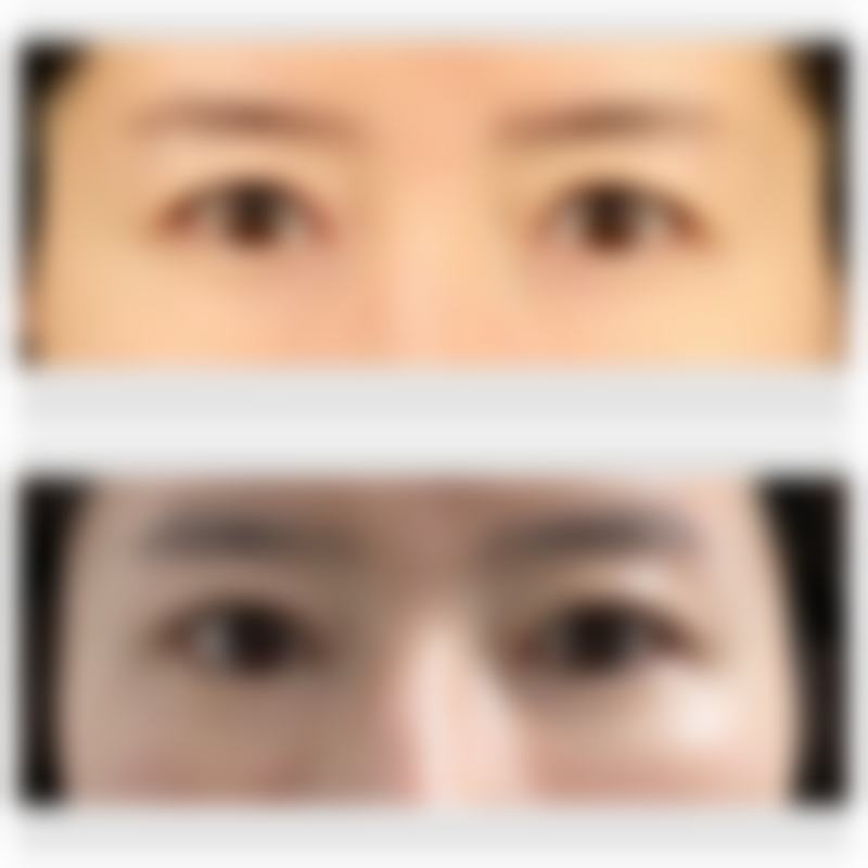 孩子脸上的疤痕变黑怎么办？附常见原因分析与改善办法，白块原因也揭秘！ 