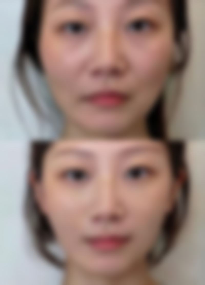 四、治疗过程中的注意事项