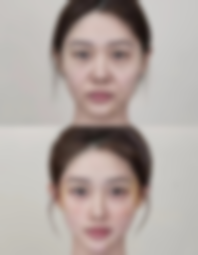 四、徐州泉山王医生(王莹)医疗美容诊所特色项目