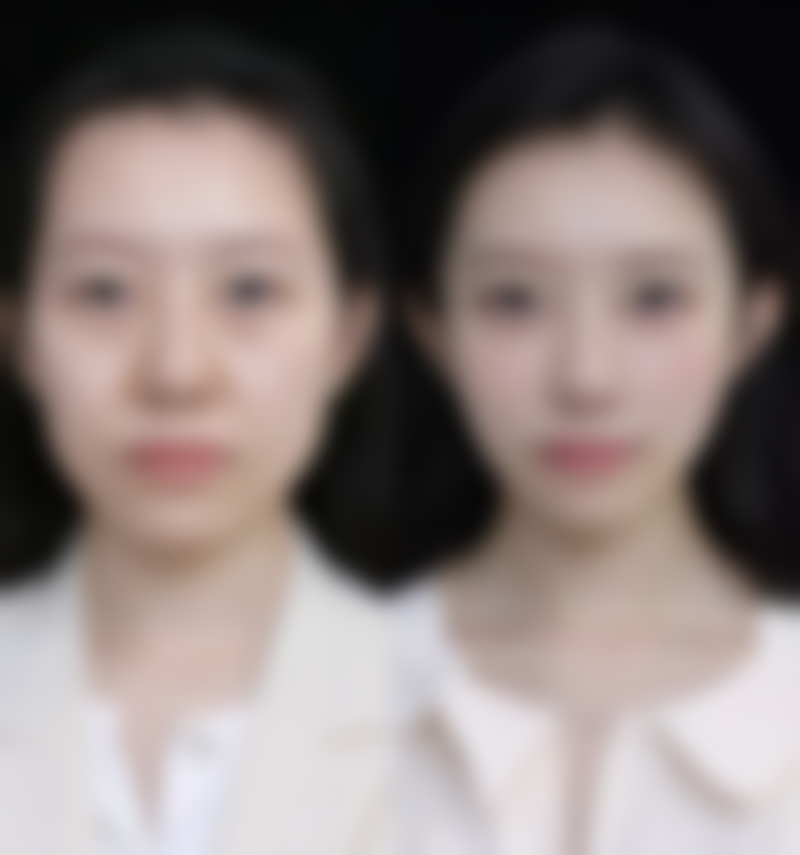 七、徐州泉山王医生(王莹)医疗美容诊所预约方式