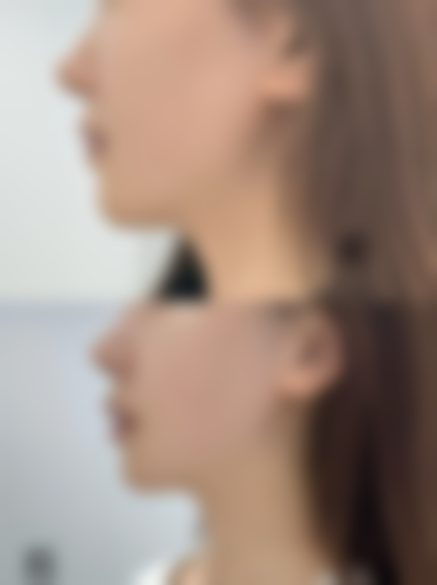 四、福建妇幼保健院整形外科特色项目