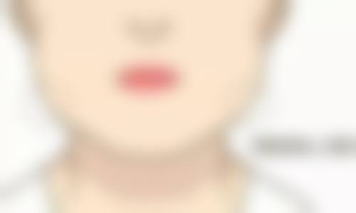 三、影响割双眼皮手术安心性的因素