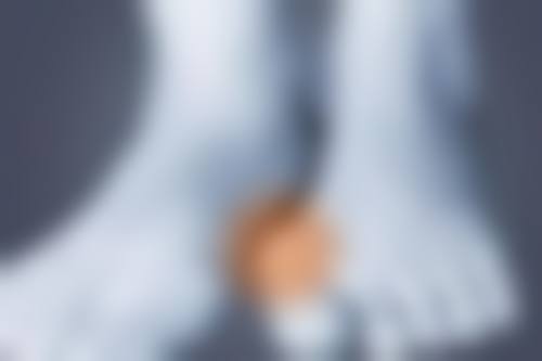 一、假体隆胸和自体隆胸的基本原理