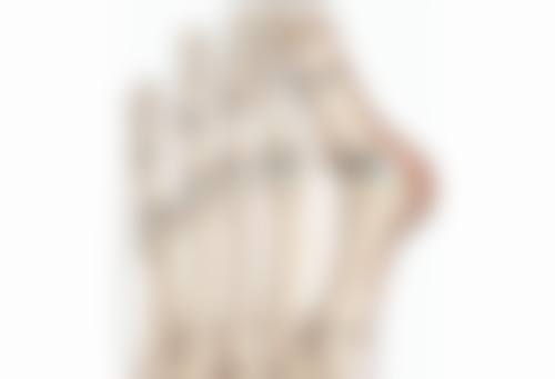 五、割双眼皮手术的美学考量