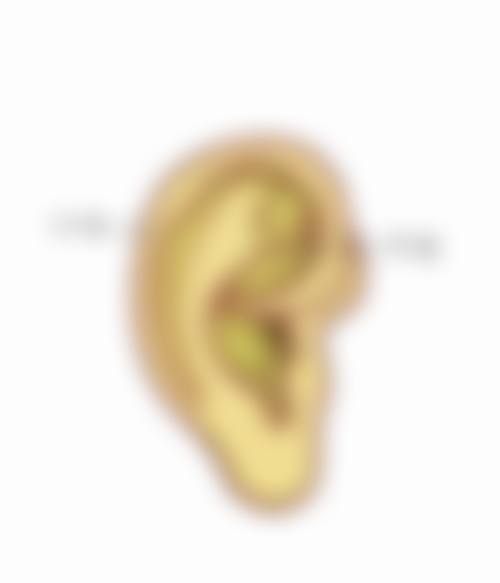 四、割完双眼皮术后护理要点