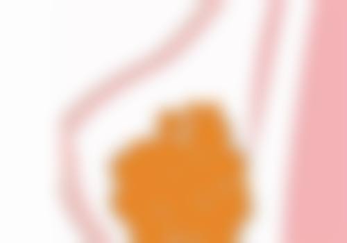 一、去眼袋成效维持时间的总体情况