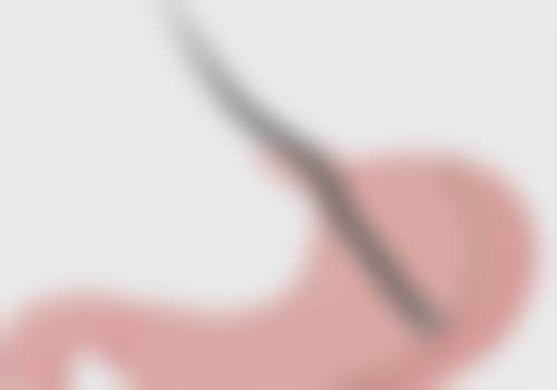 四、美学提示与应对方案