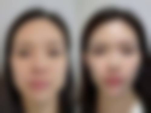 七、兰州雅森医疗美容门诊部预约方式