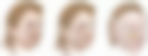 三、促进双眼皮拆线后伤口愈合的注意事项