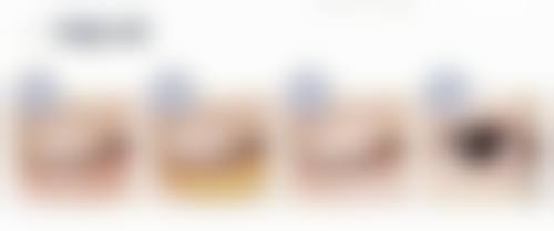 四、不同人群去眼袋成效的差异