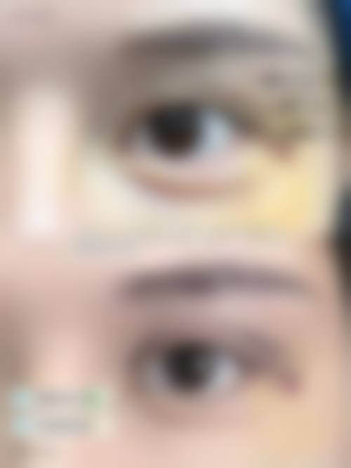 二、安顺赫尔美整形医院怎么样？