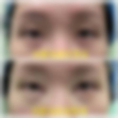 六、成都大华韩艺整形医院价格表