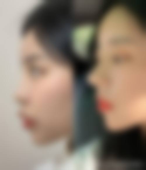 四、佛山永丽医疗美容诊所特色项目