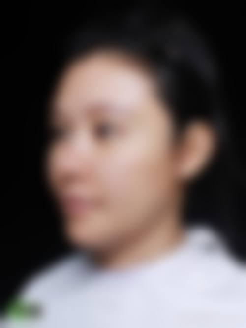 四、合肥崔劲松微创医疗美容门诊部特色项目